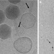 Cryo EM images of the φKZ virus (Fokine et al, Structure (2007))